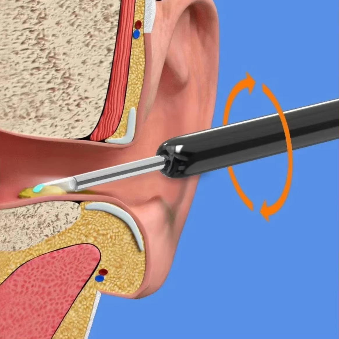 Wireless Wi-Fi Visual Ear Cleaner Otoscope Ear Wax with Ear 1296P HD Cleaning Kit Removal Sticks Endoscope Camera Tool Kit